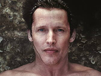 James Blunt Got Scurvy